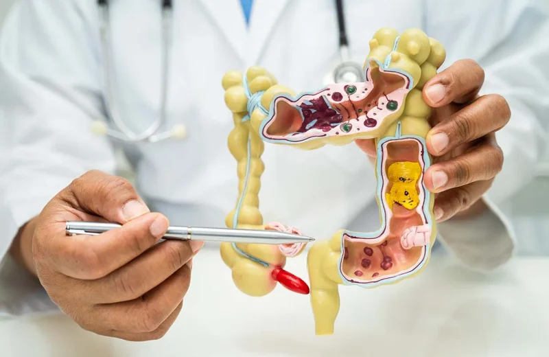 doctor-explaining-colonoscopy-pr