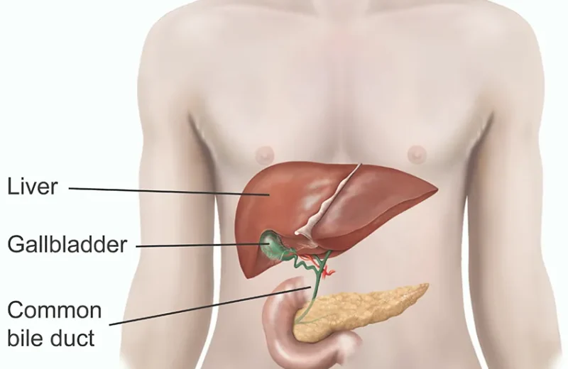 laparoscopic-cholecystectomy-6f0